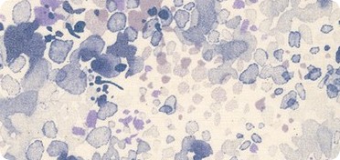 Pattern Spring Shower